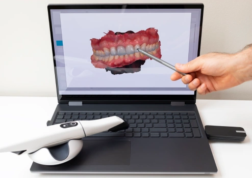 Intraoral scanner technology at Bespoke Dental Newnan in Newnan, GA, capturing precise digital impressions without discomfort.