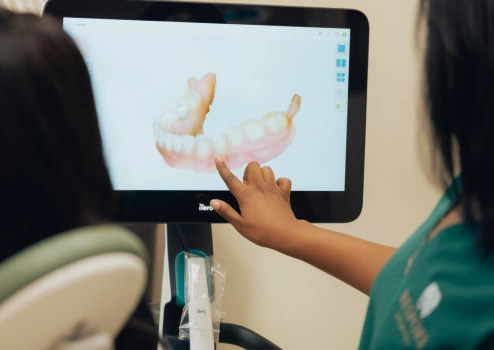 High-tech Itero scanner at Bespoke Dental Newnan in Newnan, GA, using advanced tools for faster and more effective treatments.