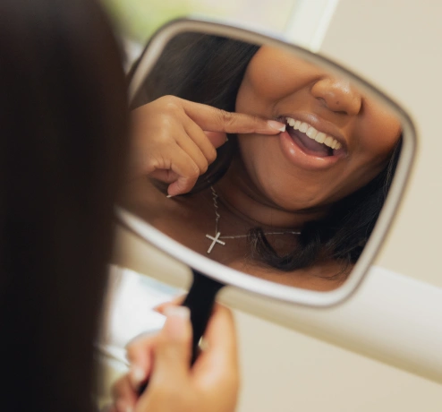 Porcelain veneers at Bespoke Dental Newnan in Newnan, GA, enhancing the shape, color, and alignment of teeth for a natural-looking, flawless smile transformation.